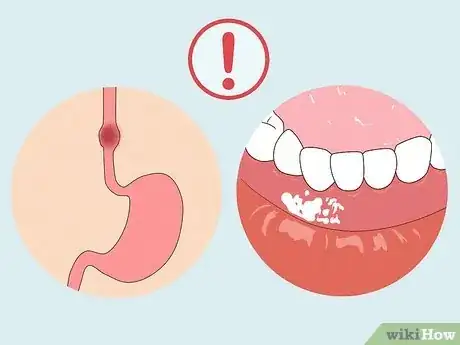 Image intitulée Chew Tobacco Step 14