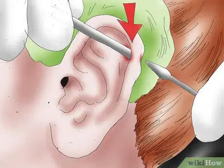 Image intitulée Get an Industrial Piercing Step 12.jpeg