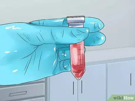 Image intitulée Know if You Have Thyroid Disease Step 11