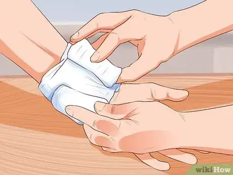 Image intitulée Treat a Facial Burn from a Curling Iron to Prevent Scars Step 5