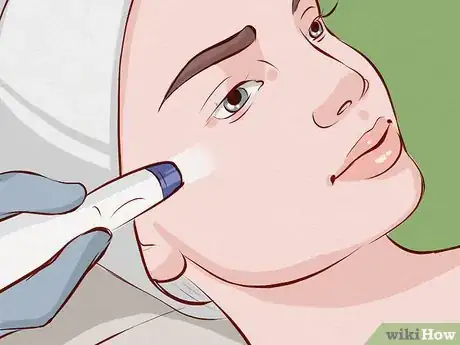 Image intitulée Get Rid of Acne Redness Step 12
