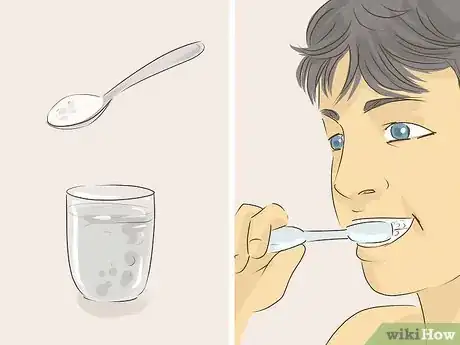 Image intitulée Recover after Wisdom Teeth Surgery Step 17