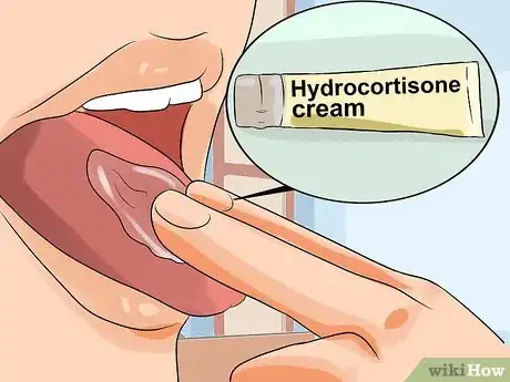 Image intitulée Get Rid of Bumps on Your Tongue Step 9