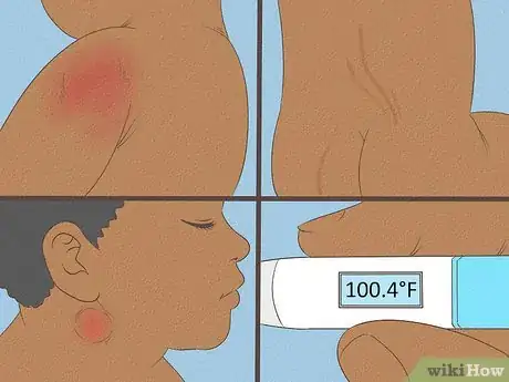 Image intitulée Know What to Expect on a Newborn's Skin Step 21