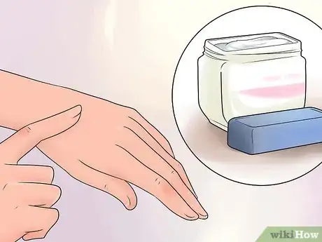 Image intitulée Treat a Burn Step 14