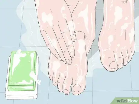 Image intitulée Cure Athlete's Foot Naturally Step 4