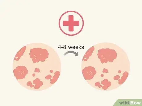 Image intitulée Have Clear Skin Naturally Step 22