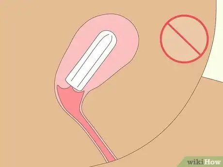 Image intitulée Use a Tampon Step 13