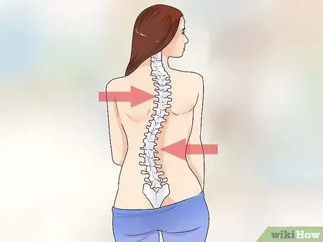 Image intitulée Treat Scoliosis Step 4