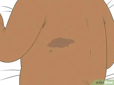 Image intitulée Know What to Expect on a Newborn's Skin Step 16