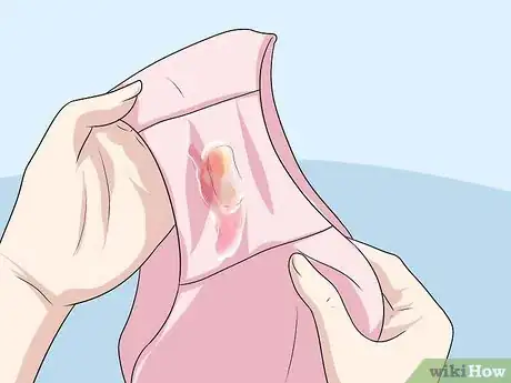 Image intitulée Recognize Chlamydia Symptoms (for Women) Step 1