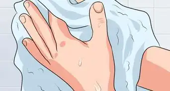 traiter un ongle incarné