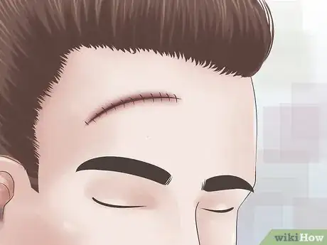 Image intitulée Get Rid of a Cut on Your Face Step 9