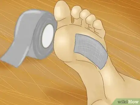 Image intitulée Remove Verrucas Step 9