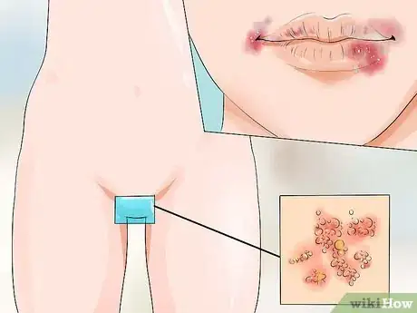 Image intitulée Start a Yeast Free Diet Step 1