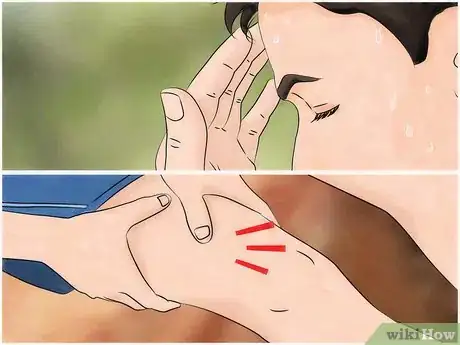 Image intitulée Identify and Treat Black Widow Spider Bites Step 3