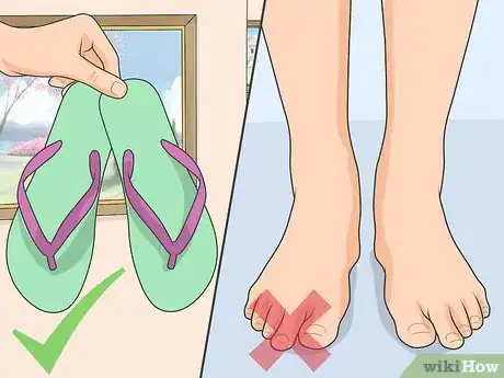 Image intitulée Treat Athlete's Foot Step 16