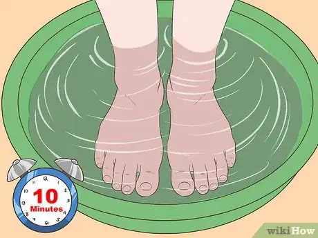 Image intitulée Fix Thick Toenails Step 1