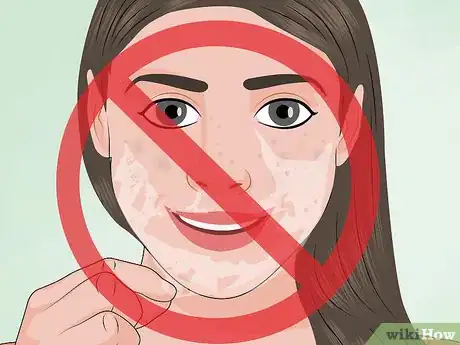 Image intitulée Apply a TCA Peel Step 18