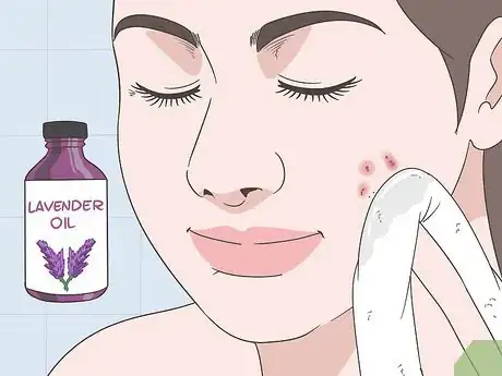 Image intitulée Create a Hot Compress for Acne Treatment and Skin Health Step 8
