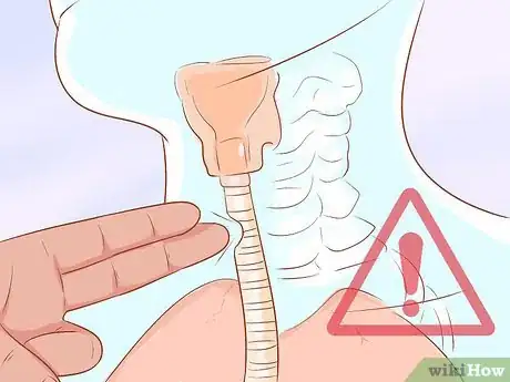 Image intitulée Knock Someone Out with One Hit Step 16
