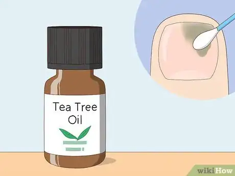 Image intitulée Heal Damaged Nails Step 11