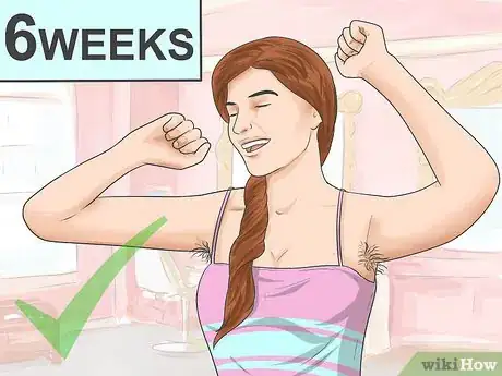 Image intitulée Stop Hair Growth Step 13