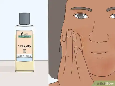 Image intitulée Heal over Exfoliated Skin Step 10