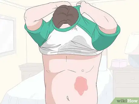 Image intitulée Treat an Ice Burn Step 2