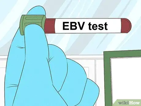 Image intitulée Differentiate Bacterial Tonsillitis and Viral Tonsillitis Step 14