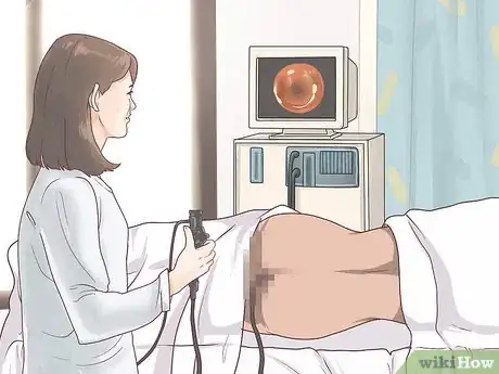 Image intitulée Self Screen for Colon Cancer Step 8