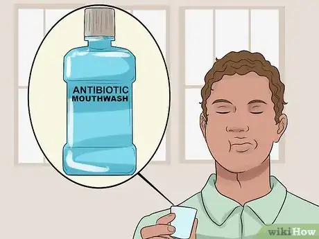 Image intitulée Stop Itchy Gums Step 17