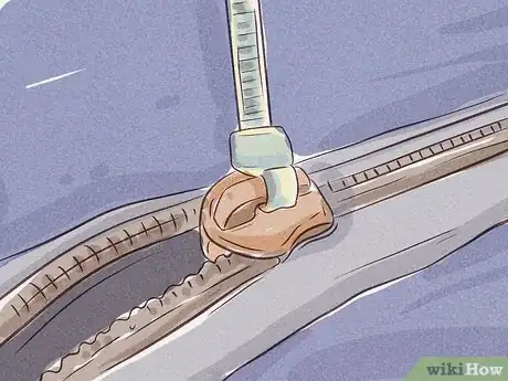 Image intitulée Fix a Tent Zipper Step 6