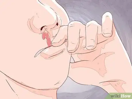 Image intitulée Differentiate Between Malaria, Dengue, and Chikungunya Step 11