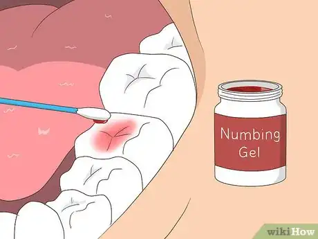 Image intitulée Cure a Toothache Step 3