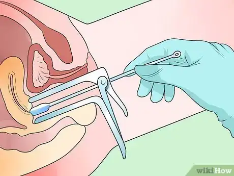 Image intitulée Recognize Chlamydia Symptoms (for Women) Step 10