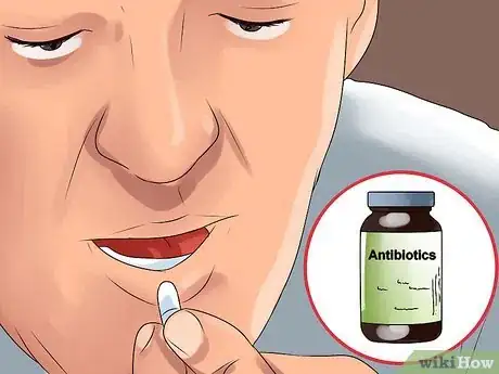 Image intitulée Cure Boils Naturally Step 10