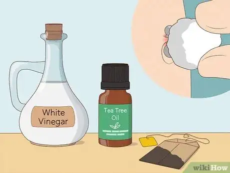 Image intitulée Treat an Irritated Belly Button Piercing Step 13