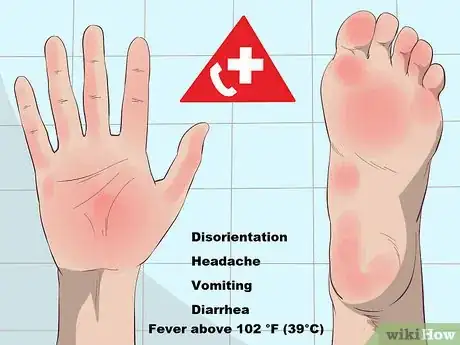 Image intitulée Recognize Staph Infection Symptoms Step 9