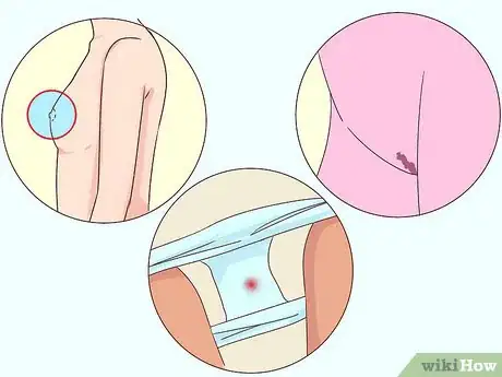 Image intitulée Know when You're Ready for a Bra Step 3