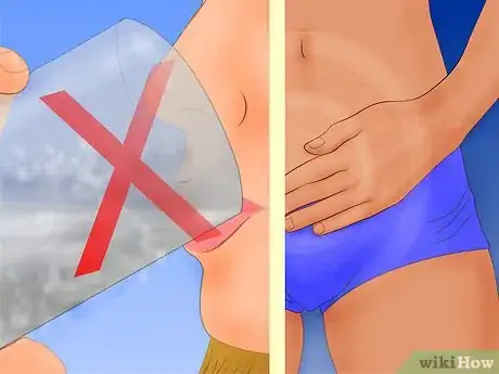 Image intitulée Do a Pap Smear Step 3