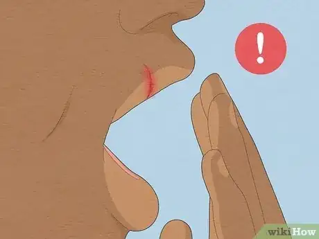 Image intitulée Treat a Cut Lip Step 14