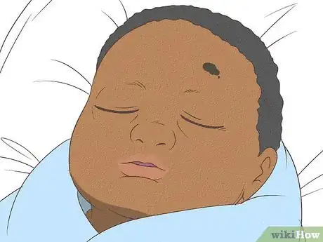 Image intitulée Know What to Expect on a Newborn's Skin Step 17
