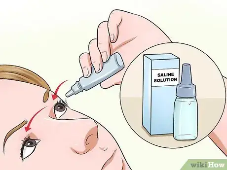 Image intitulée Remove Contact Lenses Step 2