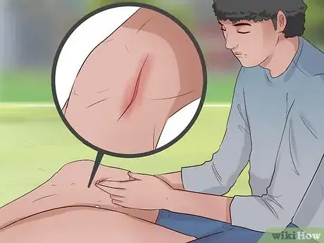 Image intitulée Hide Cuts Step 10