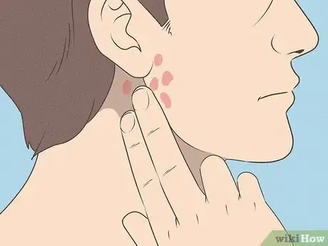 Image intitulée Differentiate Bacterial Tonsillitis and Viral Tonsillitis Step 8