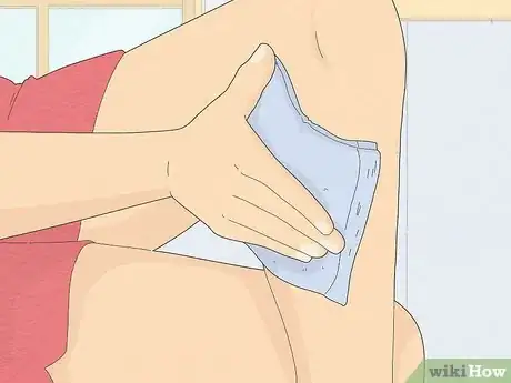 Image intitulée Remove an Ingrown Hair Under the Skin Step 7