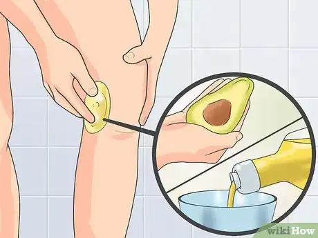 Image intitulée Naturally Stop Granuloma Annulare Step 3