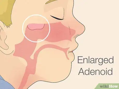 Image intitulée Make Saline Nasal Spray Step 22