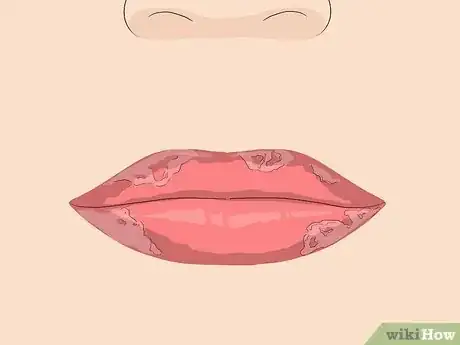Image intitulée Lighten Dark Lips from Smoking Step 10
